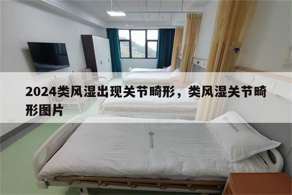 2024类风湿出现关节畸形,类风湿关节畸形图片